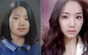 Park Min Young before and after